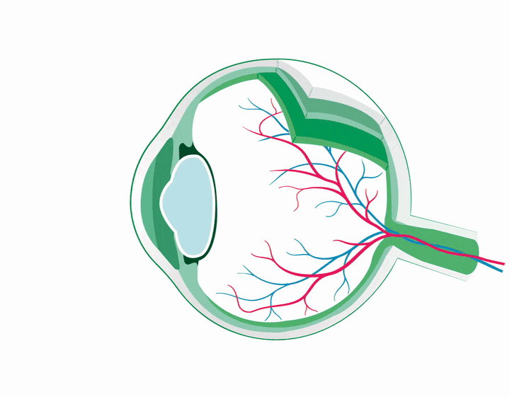 Animazione clinica — presbiopia